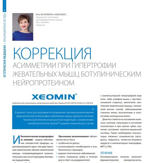 Коррекция асимметрии при гипертрофии жевательных мышц ботулиническим нейропротеином