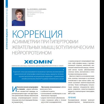 Коррекция асимметрии при гипертрофии жевательных мышц ботулиническим нейропротеином