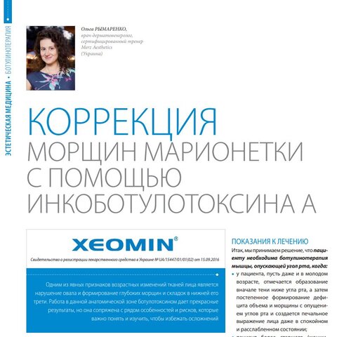 Коррекция морщин марионетки с помощью инкоботулотоксина А