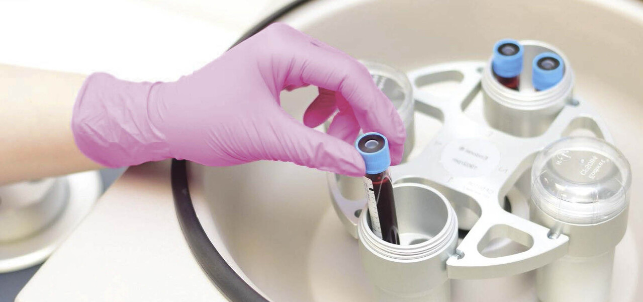 Новое слово в плазмотерапии. ENDORET® PRGF – совершенная плазма