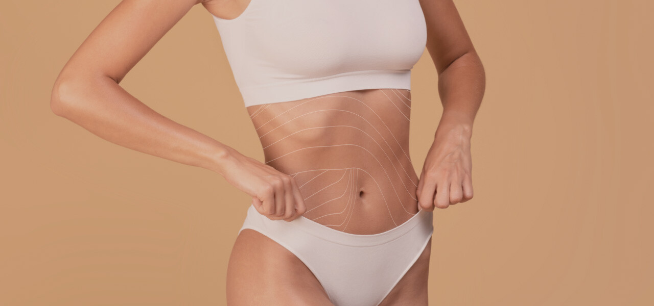 Bi One: революционная уникальная неинвазивная технология для лечения растяжек и рубцов