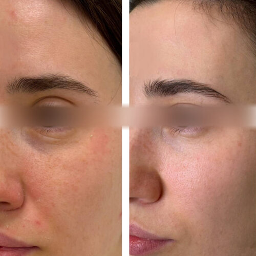 до, після 2.jpg