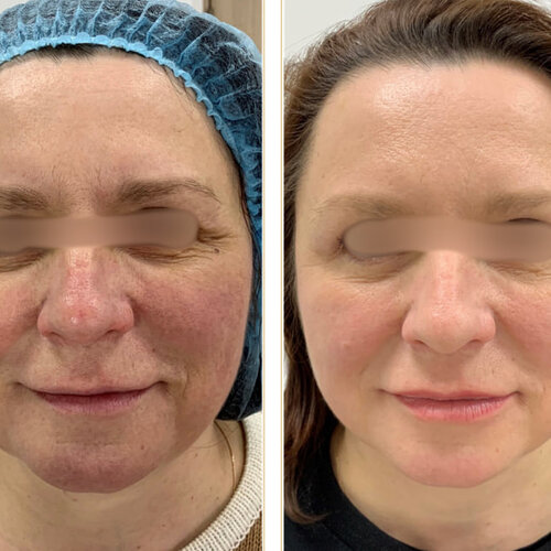 до, після 5.jpg