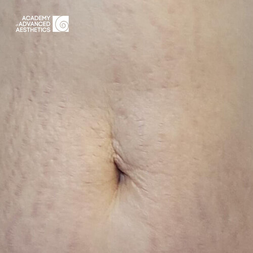 Juvelook & Lenisna_after_2