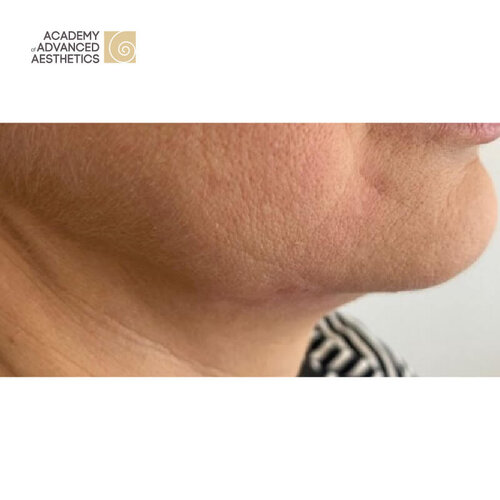 Juvelook & Lenisna_after_3