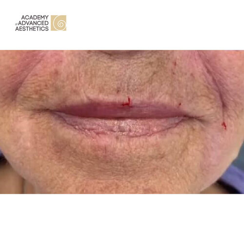 Juvelook & Lenisna_after_4