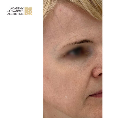 Juvelook & Lenisna_after_5