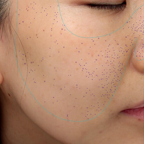 Double Tite_before_3