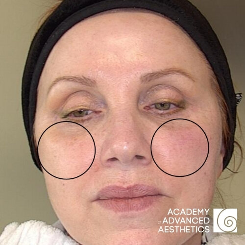 Retix.C Smart DNA Therapy_before_1