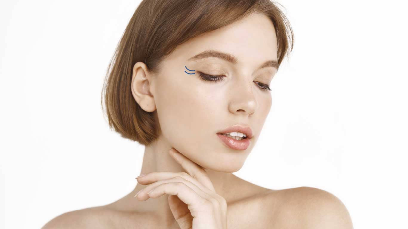 Періорбітальні