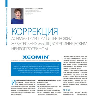 Коригування асиметрії при гіпертрофії жувальних м'язів ботулінічним нейропротеїном