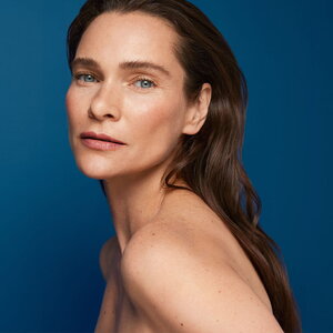 1 рівень - Radiesse у розведенні або мистецтво колагенстимуляції. Базове навчання