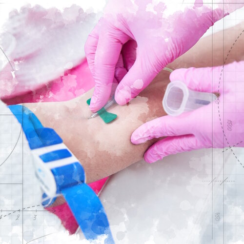 Техніка проведення внутрішньовенних ін'єкцій