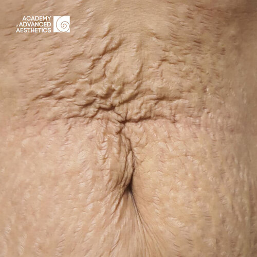 Juvelook & Lenisna_before_2