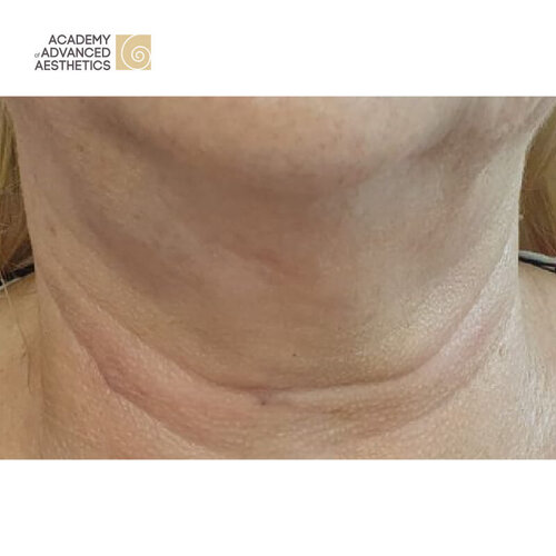 Juvelook & Lenisna_after_2