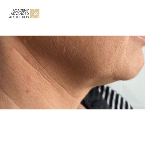 Juvelook & Lenisna_before_3