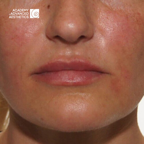 Juvelook & Lenisna_after_3