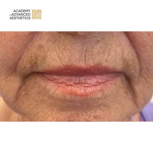 Juvelook & Lenisna_before_4