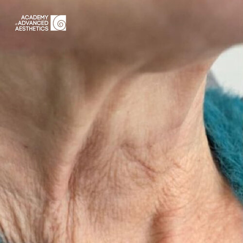 Juvelook & Lenisna_before_4