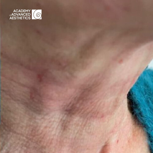 Juvelook & Lenisna_after_4