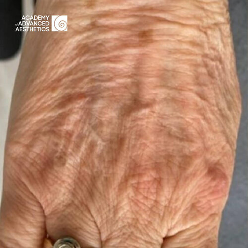 Juvelook & Lenisna_before_1