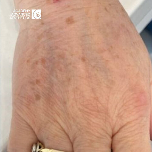 Juvelook & Lenisna_after_1