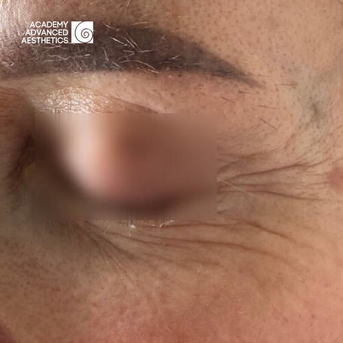 Juvelook & Lenisna_before_1