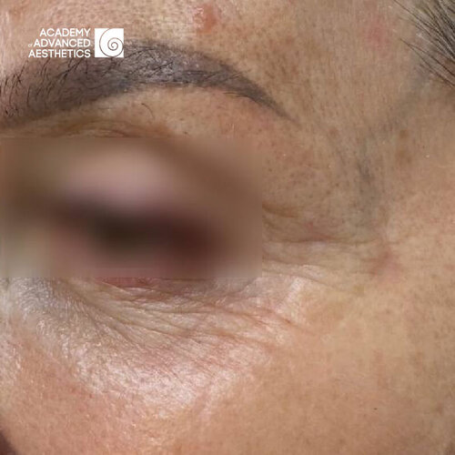 Juvelook & Lenisna_after_1