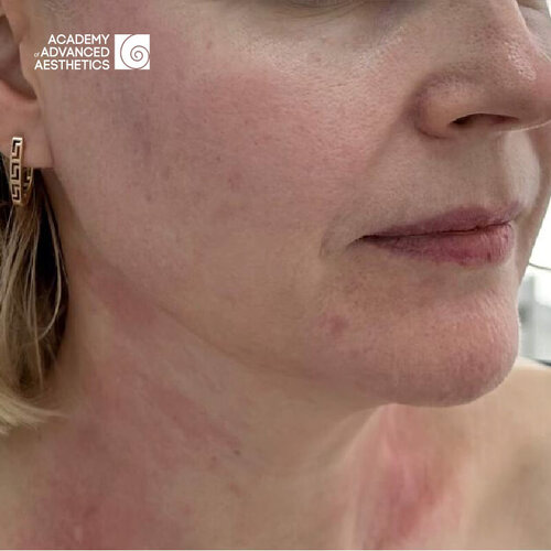 Juvelook & Lenisna_after_5