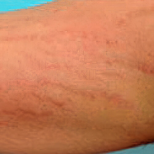 Лікування розтяжок_before_2