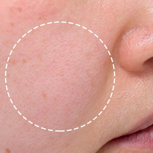 Double Tite_before_3