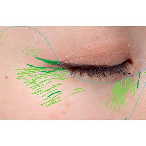 Double Tite_before_4