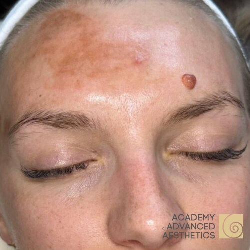 Retix.C Smart DNA комплекс_before_1