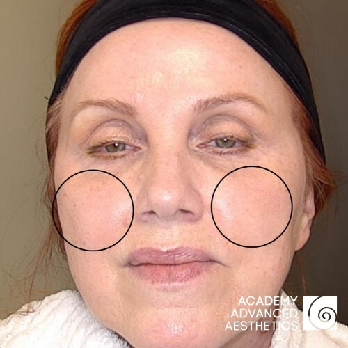 Retix.C Smart DNA комплекс_after_1