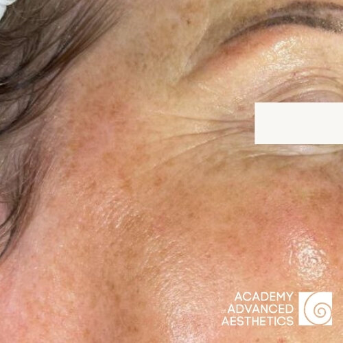 Retix.C Smart DNA комплекс_after_2